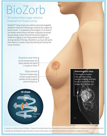 infographics_focal